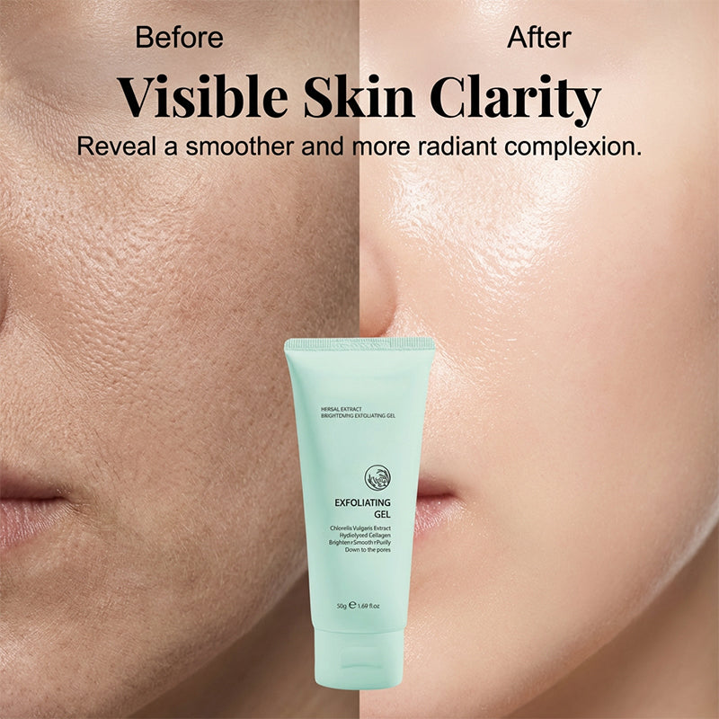 upsell-🥳2026 HOT SALE🥳💞50K+ SOLD!💥👵🌸 50% OFF!Herbal Extract Brightening Exfoliating Gel (Copy)